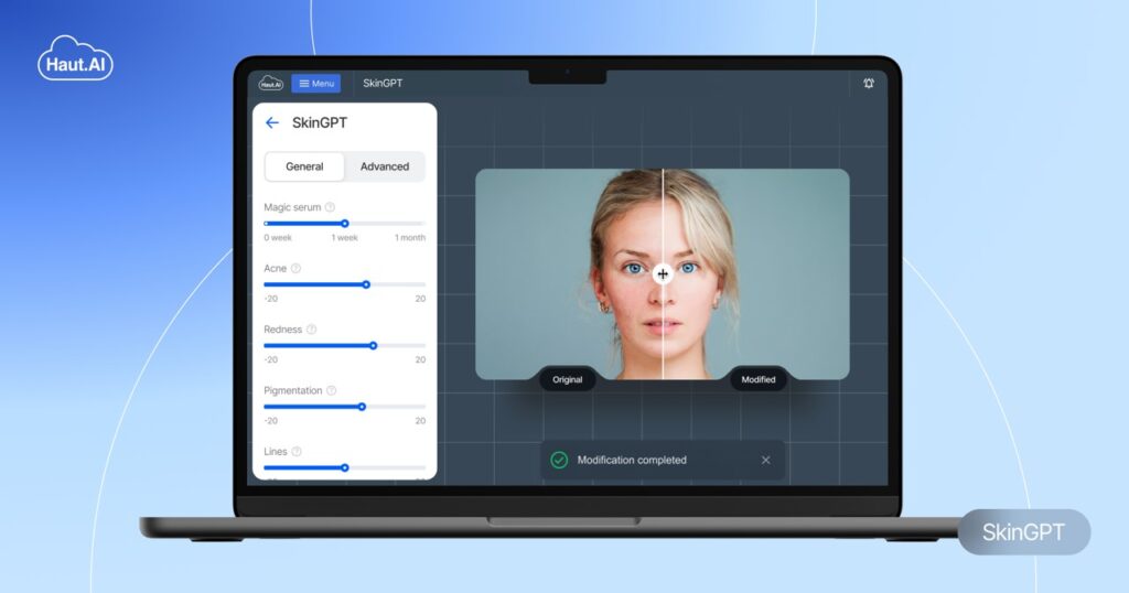 Photo of a woman's face on a computer screen showing an AI-based application called SkinGPT.