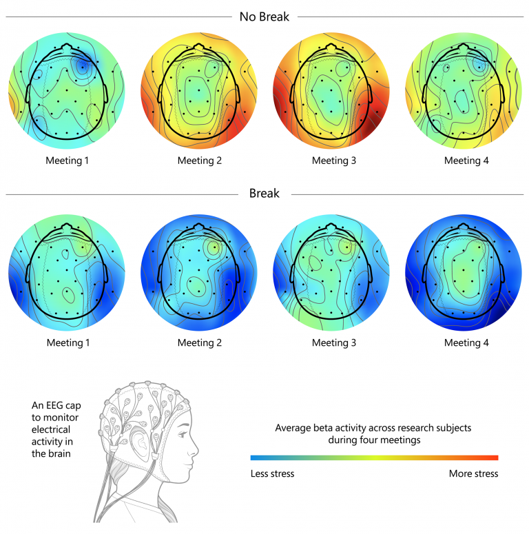 MSFT BrainScans graphic