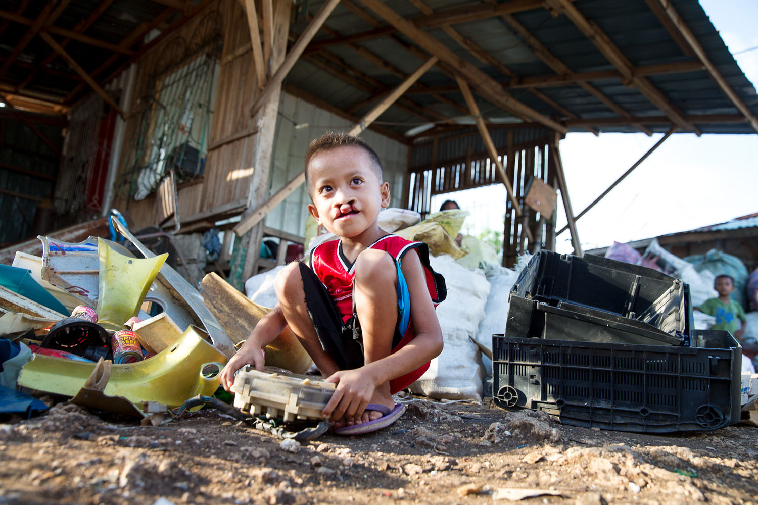 A young boy with a cleft condition squats in a rural setting near recycled scraps