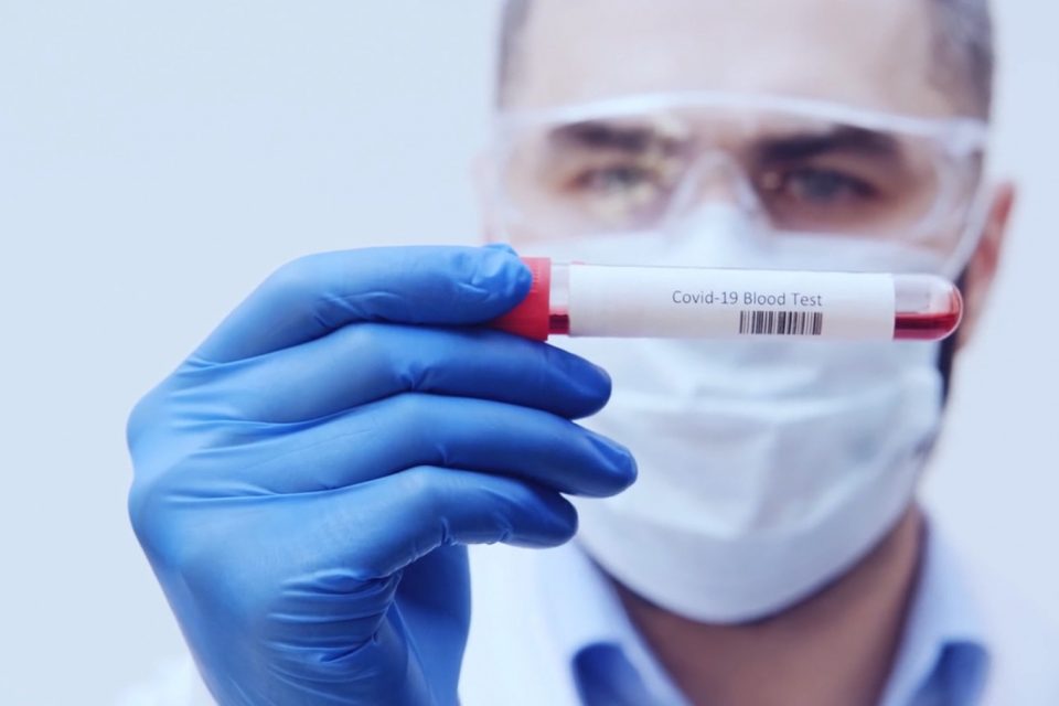 Un hombre con un tubo de muestra de laboratorio