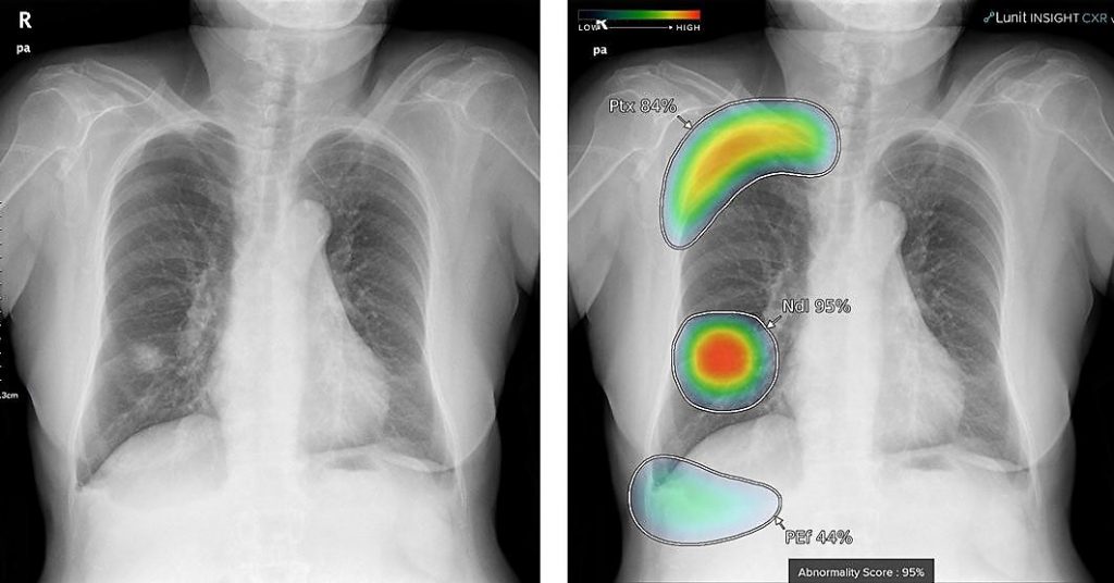 Dos conjuntos de radiografías