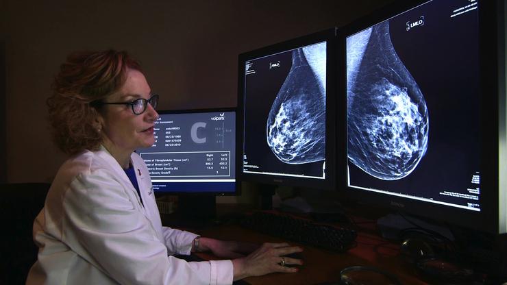 Volpara Mammogram Test